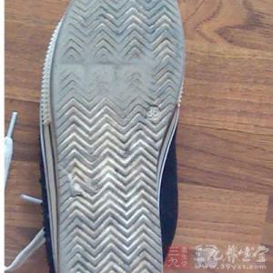 鞋底外侧磨损严重 从鞋底磨损情况辨识身体疾病