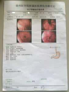 慢性胃炎 大便不成形 慢性胃炎患者为什么常大便不成形？