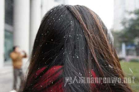 头皮屑多的原因 头皮屑多的原因 头皮屑多的病因