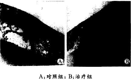 动物模型研究进展 实验性慢性高眼压模型的研究进展
