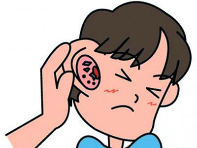 异物入耳 治异物入耳便方