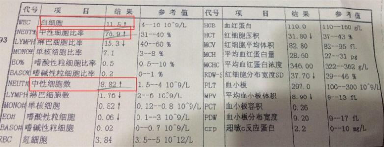 细菌性感冒 细菌性感冒与病毒性感冒的区别
