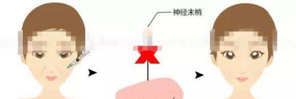 颧骨高的女人克夫吗 克夫相 如何去掉克夫相~？