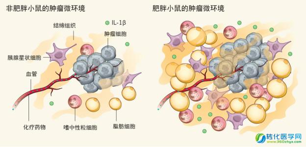 胰腺癌预后 胰腺癌脂肪和较差预后相关
