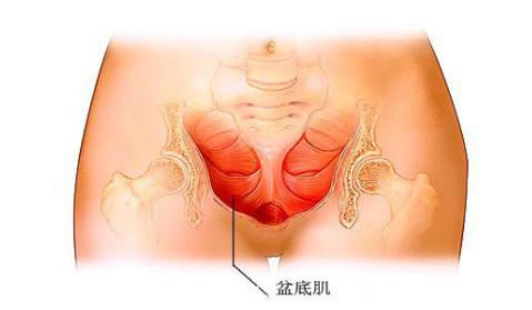 腹壁松弛需腹壁整形术 陰道壁膨出要怎么恢复 产后阴道松弛怎么改善