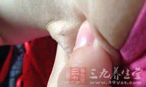 肝硬化晚期症状有哪些 肝硬化有何症状 肝硬化的危害有多大