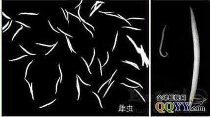 屁眼上长包包 屁眼上长了个包怎么办 你知道是这些病因引起的吗