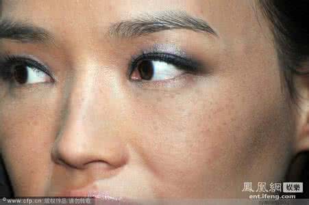 小雀斑伊顿公学受欺负 【转载】受雀斑困扰的人，不妨试试下面的偏方，其原料就是苍耳子。