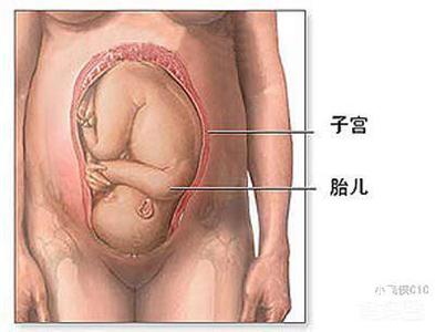 孕38周怎么促进顺产啊 孕38周怎么促进顺产啊 38周+顺产迎来带把‘猴宝宝’,成功女翻男凑好