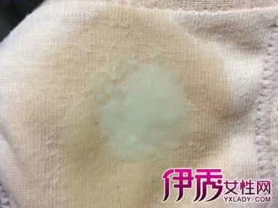 白带黄绿色是什么原因 白带黄绿色是什么原因 白带黄绿色的原因是什么