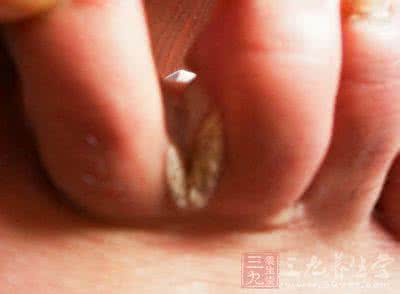 月经不正常是什么原因 月经不正常 月经不正常 究竟是什么原因