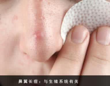 脸上痘痘挤出白色的脓 脸上痘痘挤出白色 【健康】挤痘痘挤出人命？真相竟是~~