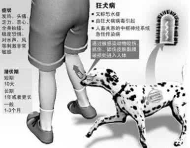 狂犬病发病 狂犬病患者发病视频 牛皮癣患者易忽略的发病因素