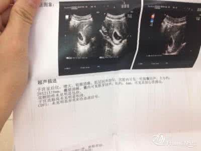 b超女宝 生下来是男宝 b超女宝 生下来是男宝 想知道怀的是男宝还是女宝？你得学会跟医生