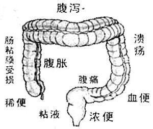 云南中医胃肠病医院 专家称胃肠病是“作”出来的