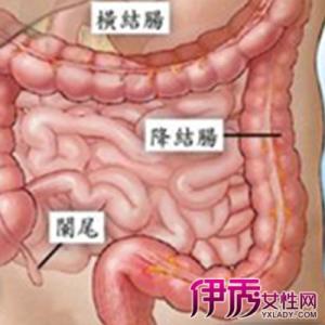 慢性盲肠炎怎么治疗 慢性盲肠炎怎么治疗?