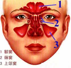 鼻窦炎鼻塞 鼻窦炎鼻塞一分钟解决妙法