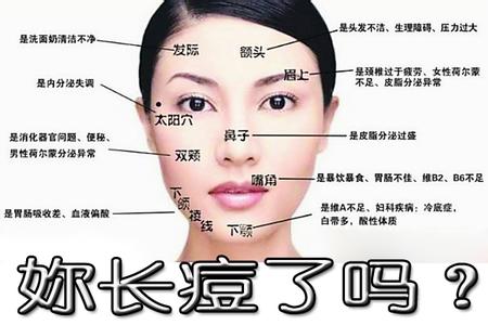 治疗面部痘痘 面部长痘痘反应身体疾病