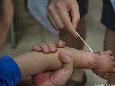 乘客随自动扶梯 长沙3岁幼童乘扶梯时跌倒 手部卷入踏板缝隙