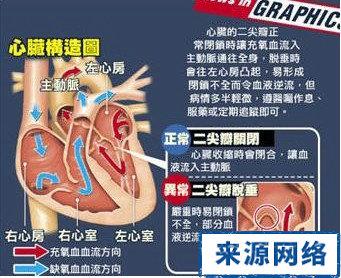 突发心脏病的症状 大S心脏病突发 心脏二尖瓣脱垂是什么病症