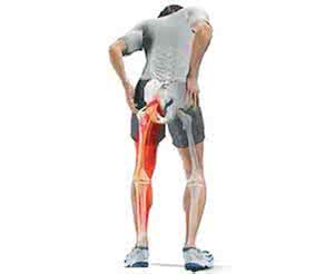 坐骨神经痛的症状 坐骨神经 坐骨神经痛怎么办 精