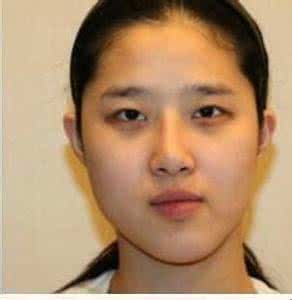 拍照左右脸严重不对称 左右脸不对称怎么办