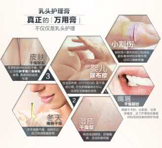 乳头霜有必要买吗 乳头霜有必要买吗 乳头膏有必要准备吗？