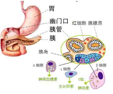 糖尿病性胃轻瘫 糖尿病性胃轻瘫 中医辨证治疗糖尿病性胃轻瘫86例