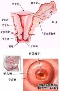 宫颈糜烂出血原因 宫颈糜烂房事后出血原因及治疗方法是什么呢？