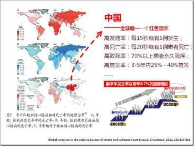 脑血栓形成多发生于 春节脑血栓多发、机械取栓除疾患