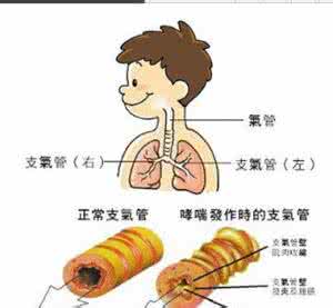 过敏性咳嗽症状 过敏性咳嗽什么症状?详解8个特征