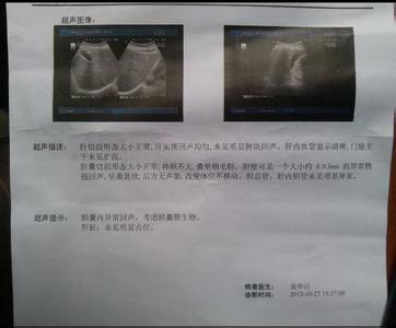 治疗胆囊炎的特效药 治胆囊炎效方三则*