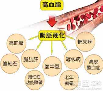 高血脂吃什么好降血脂 高血脂的危害