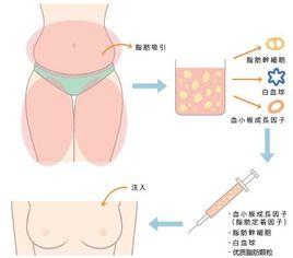 孕期如何增大乳房 如何使乳房增大不伤身体的方法