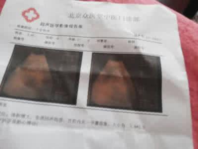 先兆性流产 【先兆性流产怎么办】先兆性流产!我该怎么办?_先兆性流产怎么办