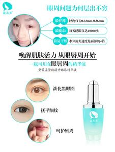 光子嫩肤是怎么回事 重新加回他却不说话 6光子让你的重新肌肤说话