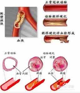 产后护肤保养小窍门 怎么养血管 日常护血管的小窍门