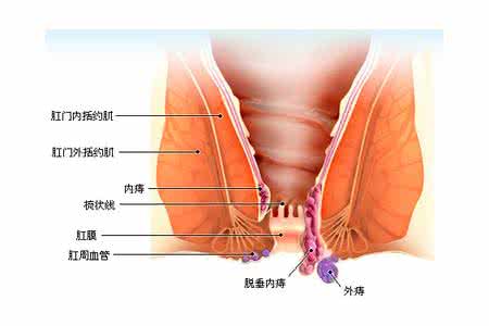 如何用枯矾治皮肤病 枯矾治外痔，不妨试一试