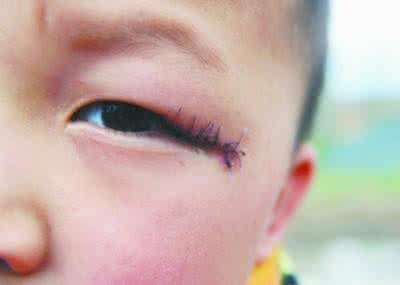 做眼角手术 日本幼儿园的一场精神教育,看完眼角湿润了!