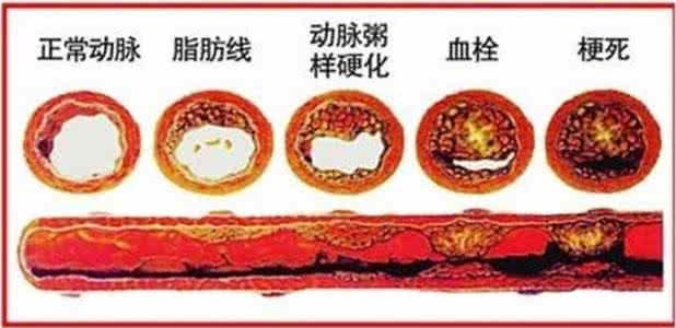 损害人民币的行为 健康 | 血管老，人就老，哪些行为损害血管健康，你都知道么？