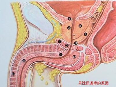 挤压尿道口白色分泌物 尿道口有白色分泌物 什么原因导致尿道泌白