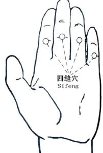 孩子体质差怎么调理 针扎四缝是调理孩子体质的好方法