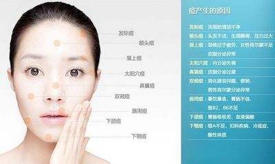 调节内分泌痘痘 成人脸上长痘 调节肾脏内分泌