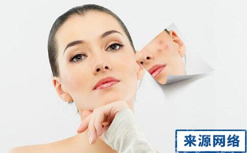 消除痘印小窍门 痘印怎么消除小妙招 美容护肤小窍门 去痘印的一些日常护理方法和技巧