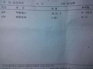 甲胎蛋白偏高怎么办 甲胎蛋白偏高的原因 甲胎蛋白偏高怎么办