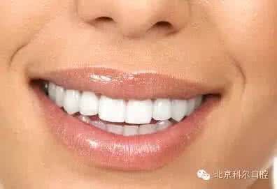 牙龈萎缩怎么办 牙龈萎缩怎么办 如何防治牙龈萎缩
