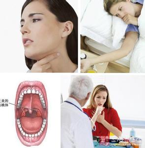 慢性咽炎的预防和治疗 慢性咽炎的预防与治疗