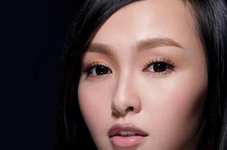 眼袋失败修复专家 专家介绍去眼袋失败修复