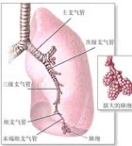 新生儿湿肺 怎么检查新生儿湿肺