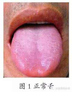 舌苔厚白嗓子嗓子痰多 舌苔厚白干燥怎么调理 舌苔厚白干燥痰多的病因